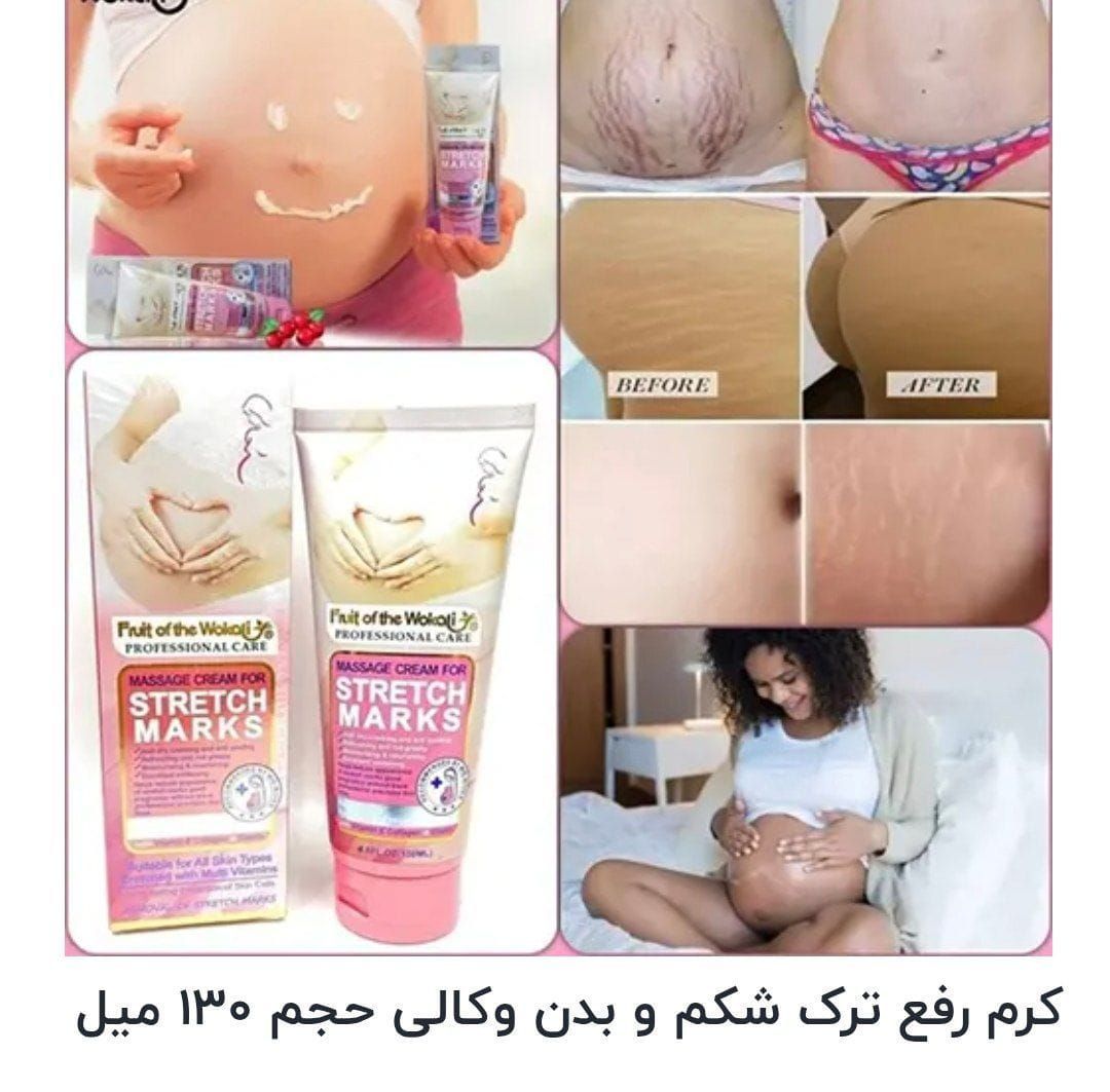 کرم ترک بدن وکالی🌸