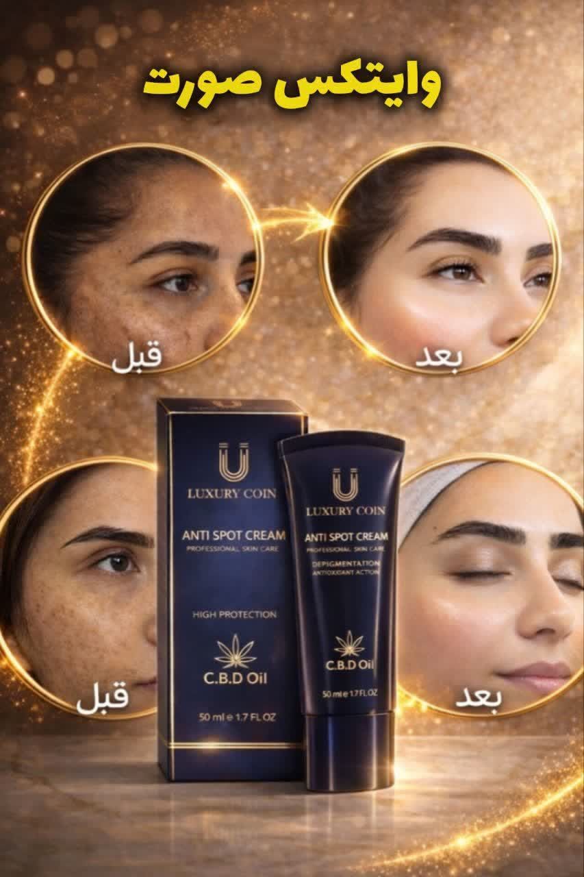 کرم ضدلک لاکچری کوین